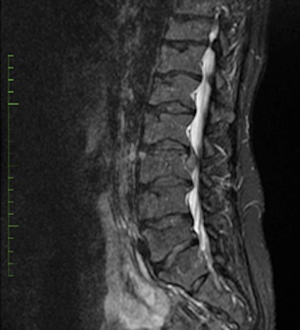 Figure 5 for case Kneist dysplasia